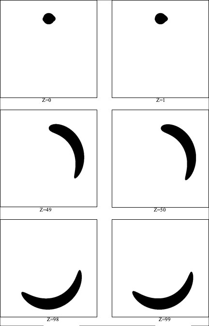 原题列出的六幅样例切片:Z=0、1、49、50、98、99。完整100幅512×512像素数据仍见题目附件。